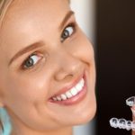 Brace Yourself for a Radiant Smile Tollgate Orthodontics in Warwick and Jamestown